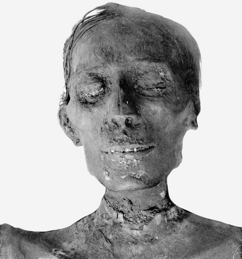 Thutmose IV mummy head